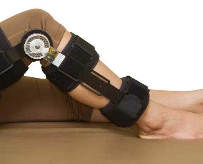 Orthopedic braces